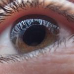 Oftalmologi: mørke pletter foran øjnene.  Hvad kan de betyde?